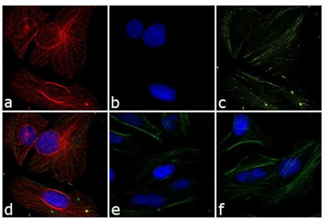 Rabbit IgG (H+L) Cross-Adsorbed Secondary Antibody in Immunocytochemistry (ICC/IF)