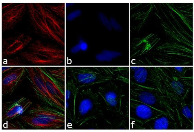 Mouse IgG (H+L) Secondary Antibody in Immunocytochemistry (ICC/IF)