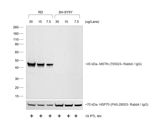 Rabbit IgG (H+L) Secondary Antibody in Western Blot (WB)