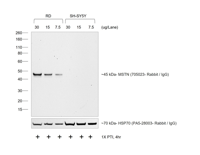 Rabbit IgG (H+L) Cross-Adsorbed Secondary Antibody in Western Blot (WB)