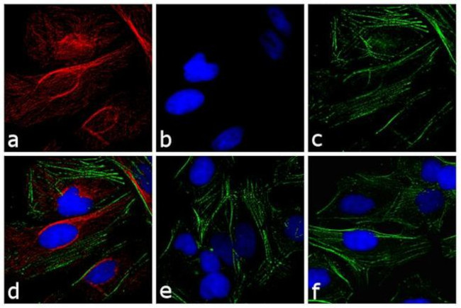 Rabbit IgG (H+L) Highly Cross-Adsorbed Secondary Antibody in Immunocytochemistry (ICC/IF)