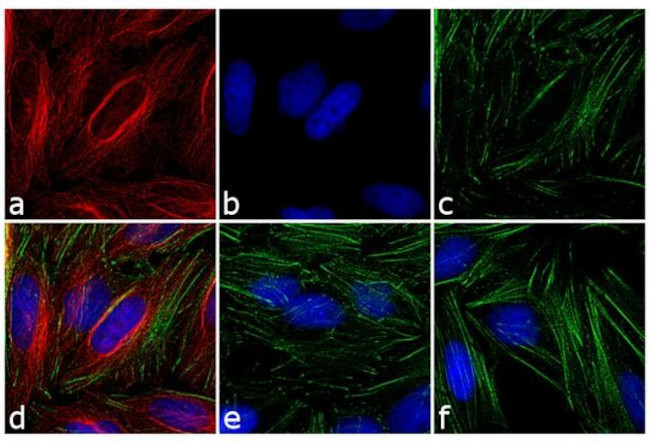 Mouse IgG (H+L) Highly Cross-Adsorbed Secondary Antibody in Immunocytochemistry (ICC/IF)