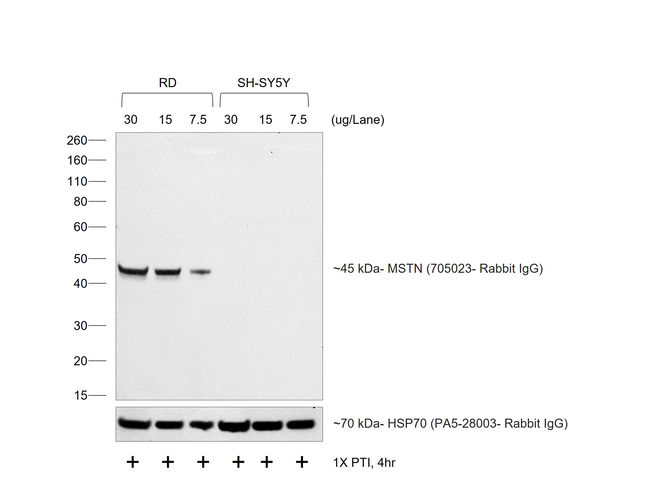 Rabbit IgG (H+L) Secondary Antibody in Western Blot (WB)