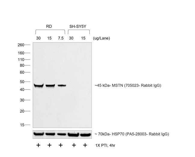 Rabbit IgG (H+L) Cross-Adsorbed Secondary Antibody in Western Blot (WB)