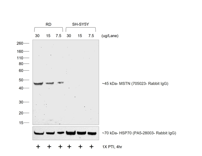 Rabbit IgG (H+L) Secondary Antibody in Western Blot (WB)