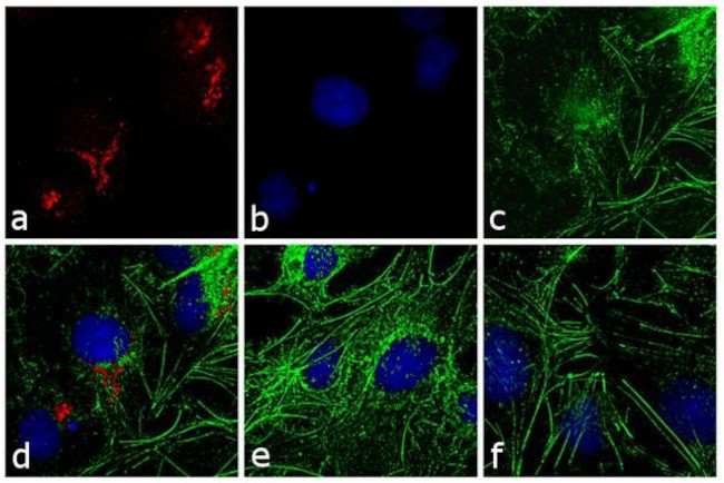 Rabbit IgG (H+L) Secondary Antibody in Immunocytochemistry (ICC/IF)