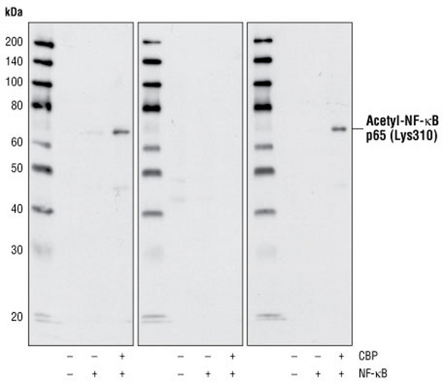 NFkB p65 Antibody in Western Blot (WB)