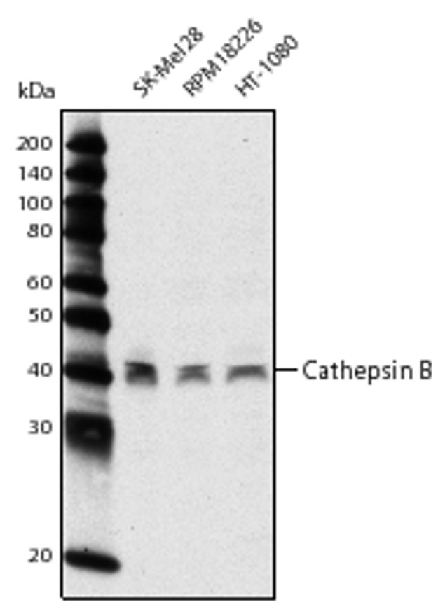 Cathepsin B Antibody in Western Blot (WB)
