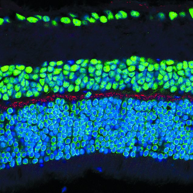 Phospho-NMDAR1 (Ser890) Antibody in Immunohistochemistry (IHC)