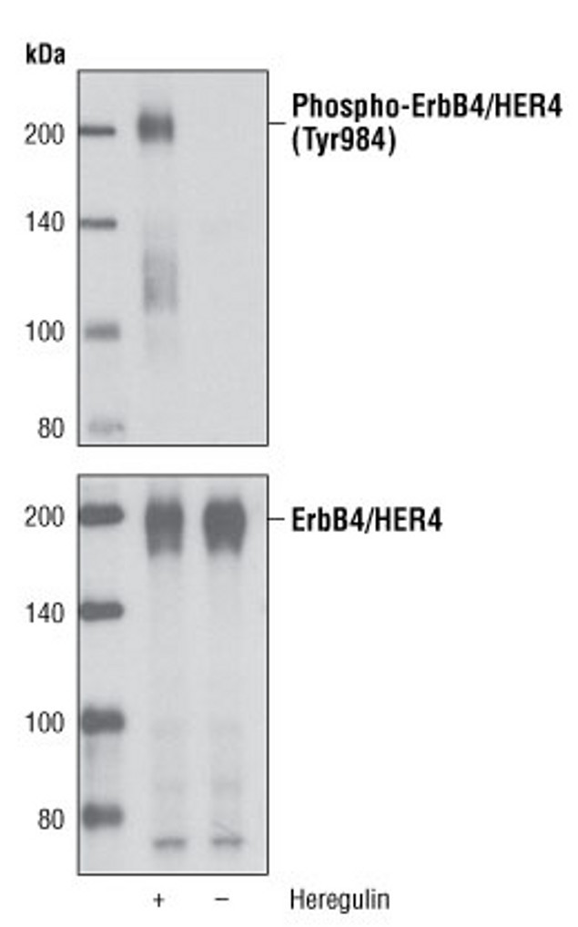 Phospho-ErbB4 (Tyr984) Antibody in Western Blot (WB)