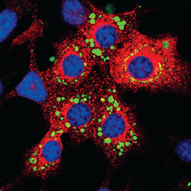 LNPEP Antibody in Immunocytochemistry (ICC/IF)