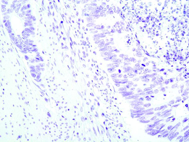 Plexin-A1 Antibody in Immunohistochemistry (Paraffin) (IHC (P))