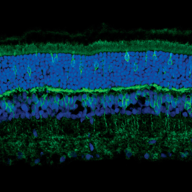 GLT-1 Antibody in Immunohistochemistry (IHC)