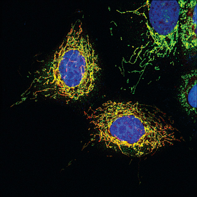 MAVS Antibody in Immunocytochemistry (ICC/IF)