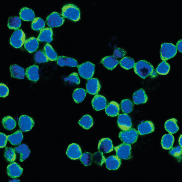 NFAT1 Antibody in Immunocytochemistry (ICC/IF)