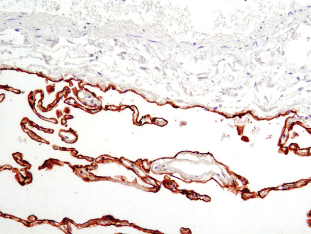 RAGE Antibody in Immunohistochemistry (Paraffin) (IHC (P))