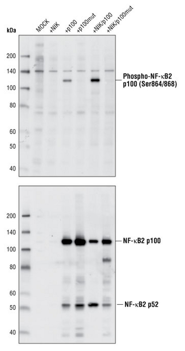 Phospho-NFkB p52 (Ser866, Ser870) Antibody in Western Blot (WB)