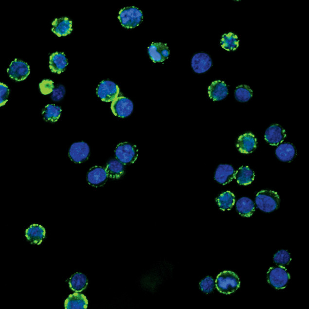 Phospho-CD79a (Tyr182) Antibody in Immunocytochemistry (ICC/IF)