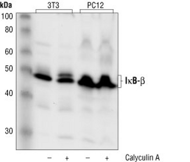 IkB beta Antibody in Western Blot (WB)