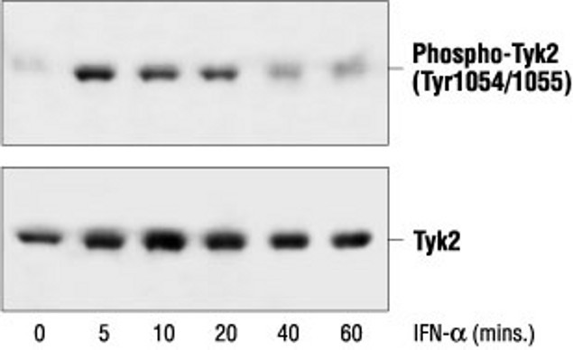 Phospho-Tyk2 (Tyr1054, Tyr1055) Antibody in Western Blot (WB)