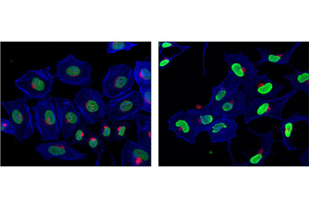 H4K8ac Antibody in Immunocytochemistry (ICC/IF)