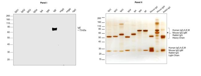 Human IgE Secondary Antibody in Western Blot (WB)