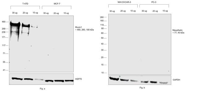 Human Kappa Light Chain Secondary Antibody in Western Blot (WB)