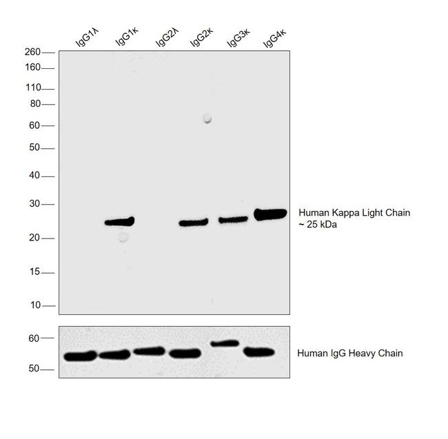 Human Kappa Light Chain Cross-Adsorbed Secondary Antibody in Western Blot (WB)