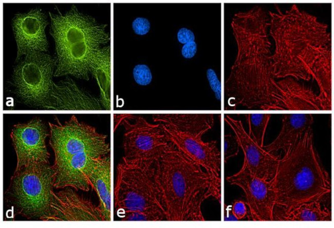 Rat IgG (H+L) Secondary Antibody in Immunocytochemistry (ICC/IF)