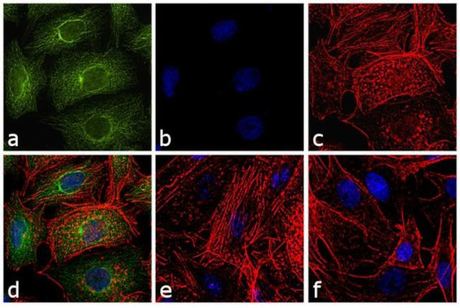 Rat IgG (H+L) Cross-Adsorbed Secondary Antibody in Immunocytochemistry (ICC/IF)