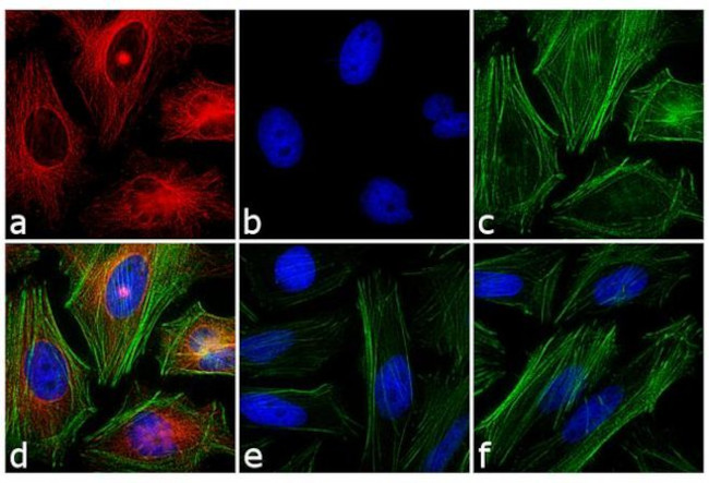 Mouse IgG1 Cross-Adsorbed Secondary Antibody in Immunocytochemistry (ICC/IF)