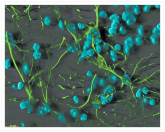 GFAP Antibody in Immunocytochemistry (ICC/IF)