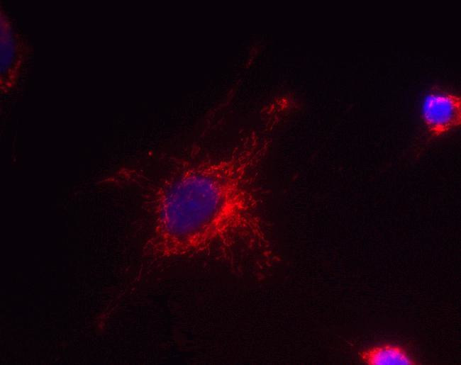 HADHB Antibody in Immunocytochemistry (ICC/IF)
