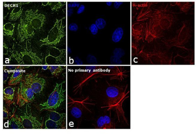 DECR1 Antibody in Immunocytochemistry (ICC/IF)