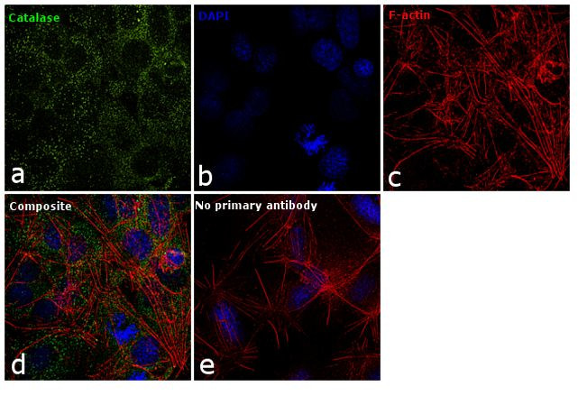 Catalase Antibody in Immunocytochemistry (ICC/IF)