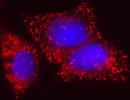 EHHADH Antibody in Immunocytochemistry (ICC/IF)