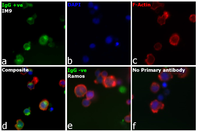 Human IgG (H+L) Secondary Antibody in Immunocytochemistry (ICC/IF)