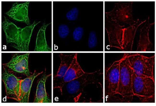 Mouse IgG (H+L) Secondary Antibody in Immunocytochemistry (ICC/IF)