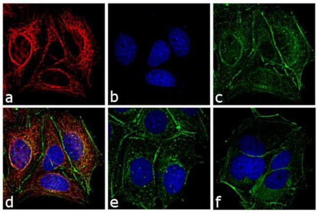 Mouse IgG (H+L) Secondary Antibody in Immunocytochemistry (ICC/IF)