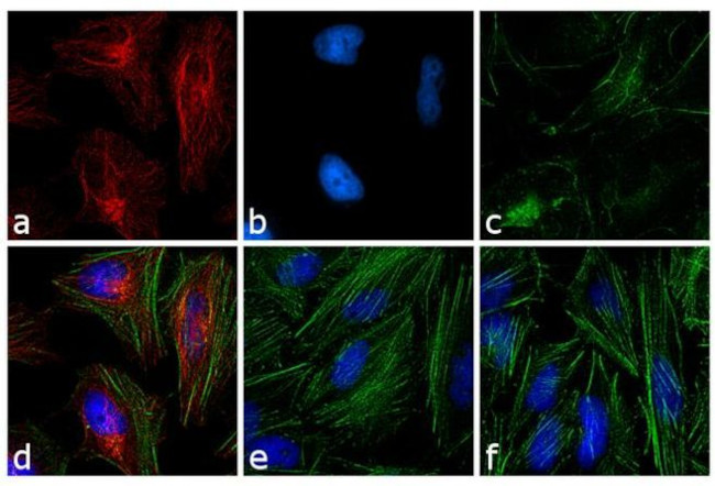 Mouse IgG (H+L) Highly Cross-Adsorbed Secondary Antibody in Immunocytochemistry (ICC/IF)