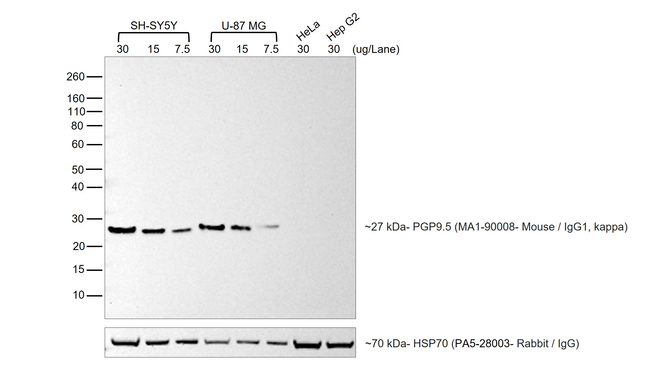 Mouse IgG (H+L) Cross-Adsorbed Secondary Antibody in Western Blot (WB)