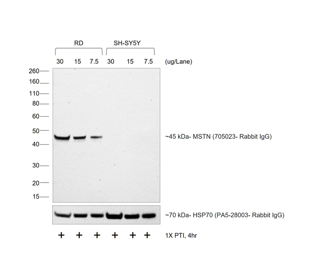Rabbit IgG (H+L) Secondary Antibody in Western Blot (WB)