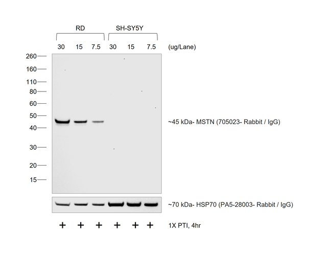 Rabbit IgG (H+L) Cross-Adsorbed Secondary Antibody in Western Blot (WB)