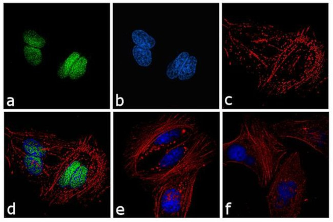 Rabbit IgG (H+L) Cross-Adsorbed Secondary Antibody in Immunocytochemistry (ICC/IF)