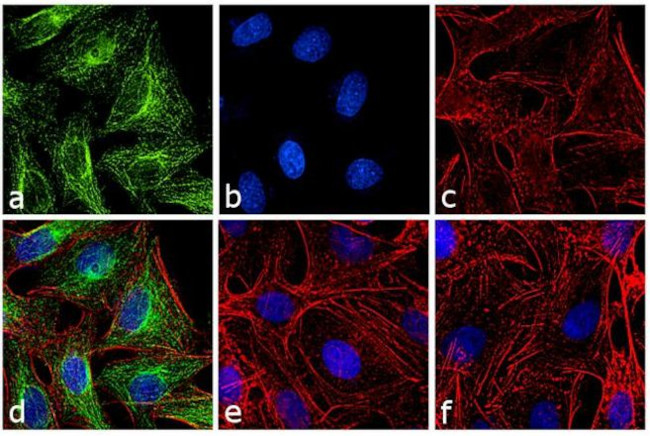 Rat IgG (H+L) Highly Cross-Adsorbed Secondary Antibody in Immunocytochemistry (ICC/IF)