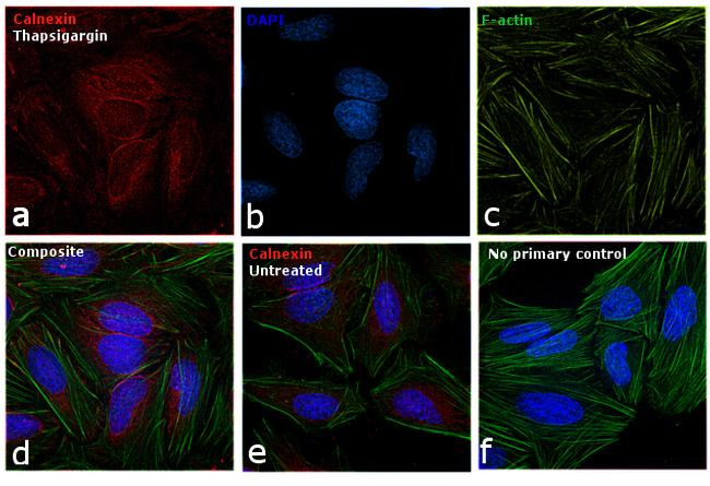 Goat IgG (H+L) Secondary Antibody in Immunocytochemistry (ICC/IF)