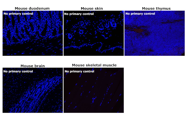 Mouse IgG (H+L) Secondary Antibody in Immunohistochemistry (Paraffin) (IHC (P))