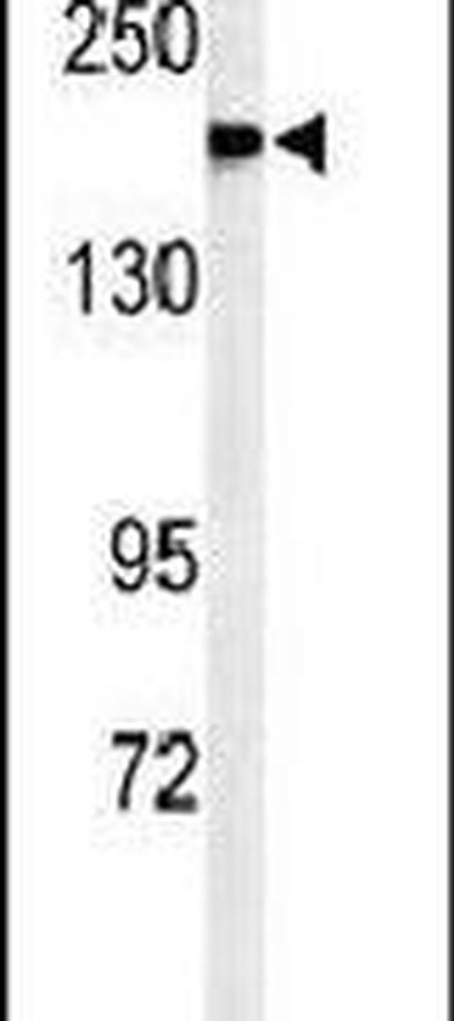 A2ML1 Antibody in Western Blot (WB)