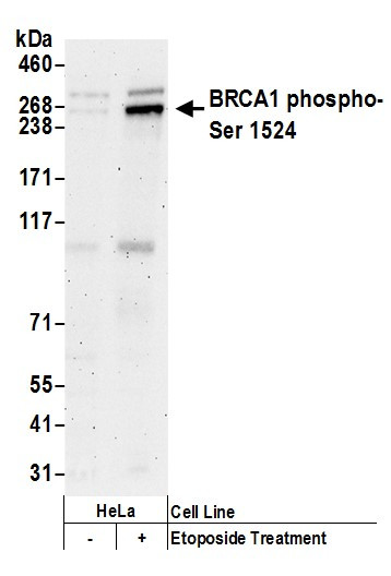 Phospho-BRCA1 (Ser1524) Antibody in Western Blot (WB)
