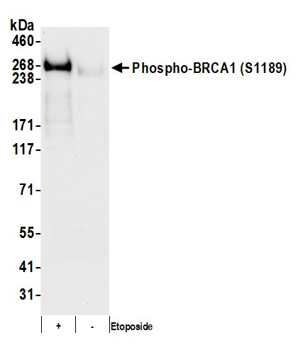 Phospho-BRCA1 (Ser1189) Antibody in Western Blot (WB)